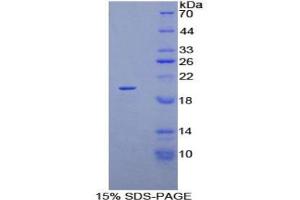 SDS-PAGE analysis of Human Keratin 81 Protein. (KRT81 蛋白)