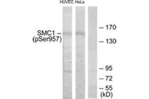 Western blot analysis of extracts from HuvEc cells treated with EGF 200ng/ml 5'/HeLa cells treated with EGF 200ng/ml 15', using SMC1 (Phospho-Ser957) Antibody. (SMC1A 抗体  (pSer957))