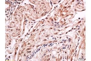 Formalin-fixed and paraffin embedded rat placenta labeled with Anti-FOXF1 Polyclonal Antibody, Unconjugated  at 1:200 followed by conjugation to the secondary antibody and DAB staining. (FOXF1 抗体  (AA 285-379))