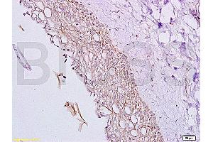 Formalin-fixed and paraffin embedded rat ovary tissue labeled with Anti-Inhibin Alpha Polyclonal Antibody, Unconjugated (ABIN736656) at 1:200, followed by conjugation to the secondary antibody and DAB staining (Inhibin alpha 抗体  (AA 301-366))