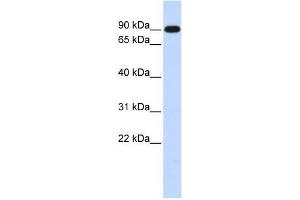 Human Muscle; WB Suggested Anti-ZXDA Antibody Titration: 0. (ZXDA 抗体  (Middle Region))