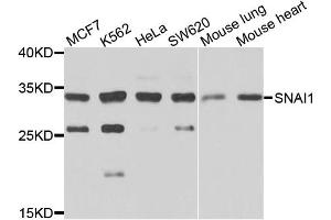 Western blot analysis of extracts of various cell lines, using SNAI1 antibody. (SNAIL 抗体)