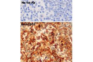 Immunohistochemistry (IHC) image for anti-Platelet/endothelial Cell Adhesion Molecule (PECAM1) (C-Term) antibody (ABIN6254202) (CD31 抗体  (C-Term))