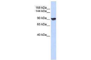 Alpha Actinin 1 antibody used at 1 ug/ml to detect target protein. (ACTN1 抗体  (N-Term))