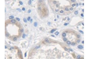 Detection of ME2 in Human Kidney Tissue using Polyclonal Antibody to Malic Enzyme 2, NADP+ Dependent, Mitochondrial (ME2) (Malic Enzyme 2, NADP+ Dependent, Mitochondrial (AA 220-426) 抗体)