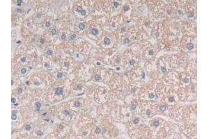 Detection of MIB2 in Human Liver Tissue using Polyclonal Antibody to Mindbomb Homolog 2 (MIB2) (MIB2 抗体  (AA 687-930))