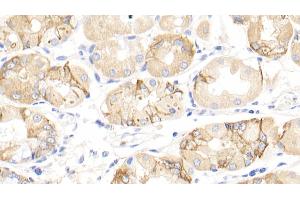 Detection of INHbA in Human Stomach Tissue using Polyclonal Antibody to Inhibin Beta A (INHbA) (INHBA 抗体  (AA 311-426))