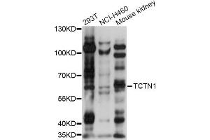 Western blot analysis of extracts of various cell lines, using TCTN1 antibody (ABIN6292813) at 1:1000 dilution. (TCTN1 抗体)
