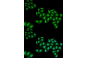 Immunofluorescence analysis of HeLa cells using DDX1 antibody (ABIN5973950). (DDX1 抗体)