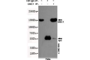 Immunoprecipitation analysis of Hela cell lysates using DBC1 mouse mAb. (DBC1 抗体)
