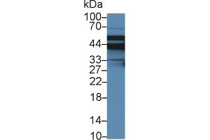 Detection of SLC9A3R2 in Porcine Liver lysate using Polyclonal Antibody to Sodium Hydrogen Exchange Regulatory Cofactor 2 (SLC9A3R2)