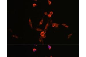 Immunofluorescence analysis of NIH/3T3 cells using PIK3CA Polyclonal Antibody at dilution of 1:100. (PIK3CA 抗体)