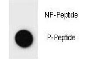 Dot Blot (DB) image for anti-Mast/stem Cell Growth Factor Receptor (KIT) (pTyr362) antibody (ABIN3031695)