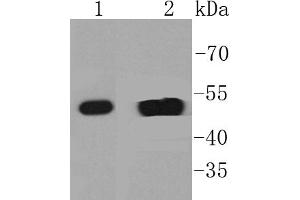 Lane 1: A431 Cell lysates, Lane 2: Human skin lysates, probed with Cytokeratin 14 (2F11) Monoclonal Antibody  at 1:1000 overnight at 4˚C. (KRT14 抗体)