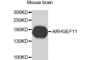 Western blot analysis of extracts of mouse brain, using ARHGEF11 antibody. (ARHGEF11 抗体)