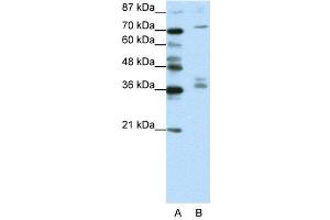 WB Suggested Anti-AKAP9  Antibody Titration: 1. (AKAP9 抗体  (N-Term))
