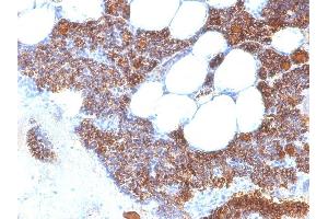 Formalin-fixed, paraffin-embedded human Parathyroid stained with PTH Mouse Monoclonal Antibody (SPM604). (PTH 抗体  (AA 1-34))