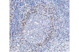 IHC analysis of ADK using anti-ADK antibody (ABIN4886430). (ADK 抗体  (AA 165-351))