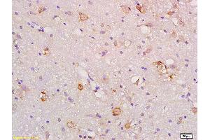 Formalin-fixed and paraffin embedded rat brain labeled with Anti-Gas1 Polyclonal Antibody, Unconjugated (ABIN872751) at 1:200 followed by conjugation to the secondary antibody and DAB staining. (GAS1 抗体  (AA 101-200))