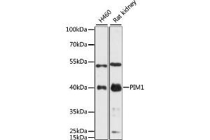 Western blot analysis of extracts of various cell lines, using PIM1 antibody (ABIN6128456, ABIN6145654, ABIN6145656 and ABIN6218499) at 1:3000 dilution. (PIM1 抗体  (AA 1-313))