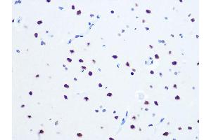Immunohistochemistry of paraffin-embedded rat brain using DHX9/DHX9/RNA Helicase A Rabbit mAb (ABIN7265747) at dilution of 1:100 (40x lens). (DHX9 抗体)