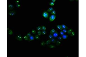 Immunofluorescence staining of Hela cells with ABIN7175336 at 1:100, counter-stained with DAPI. (VPS25 抗体  (AA 1-176))