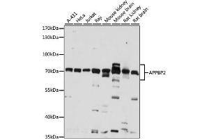 Western blot analysis of extracts of various cell lines, using  antibody (ABIN7265579) at 1:1000 dilution. (APPBP2 抗体  (AA 386-585))
