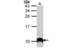 WB Image Sample (30 ug of whole cell lysate) A: A431 , 15% SDS PAGE antibody diluted at 1:1000 (COX7B2 抗体)