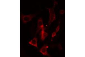 Immunofluorescence (fixed cells) (IF/ICC) image for anti-Cytochrome P450, Family 2, Subfamily A, Polypeptide 13 (CYP2A13) antibody (ABIN6258061)