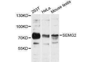 Western blot analysis of extracts of various cell lines, using SEMG2 antibody (ABIN6290952) at 1:3000 dilution. (SEMG2 抗体)