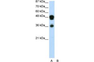 Western Blotting (WB) image for anti-Forkhead Box A1 (FOXA1) antibody (ABIN2460520) (FOXA1 抗体)