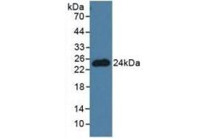 Detection of PNOC in Mouse Brain Tissue using Polyclonal Antibody to Pronociceptin (PNOC) (Pronociceptin (AA 12-187) 抗体)