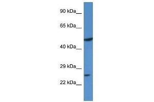Western Blot showing KLF17 antibody used at a concentration of 1. (KLF17 抗体  (N-Term))