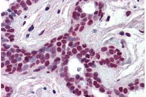 Human Breast (formalin-fixed, paraffin-embedded) stained with CUL3 antibody ABIN218508 at 1:500 followed by biotinylated goat anti-rabbit IgG secondary antibody ABIN481713, alkaline phosphatase-streptavidin and chromogen. (Cullin 3 抗体  (N-Term))
