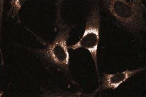 Immunoflourescent staining on WI-38 cells. (RAB5 抗体  (AA 1-215))