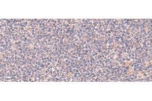 Immunohistochemistry of paraffin-embedded Human tonsil tissue using MANSC1 Polyclonal Antibody at dilution of 1:105(x200) (MANSC1 抗体)