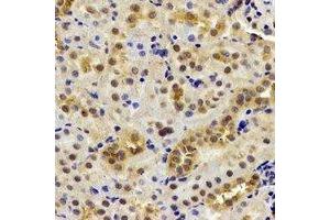 Immunohistochemical analysis of DDX1 staining in mouse kidney formalin fixed paraffin embedded tissue section. (DDX1 抗体)