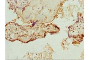 Immunohistochemistry of paraffin-embedded human placenta tissue using ABIN7176144 at dilution of 1:100 (ZNF195 抗体  (AA 1-250))