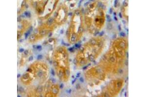 Used in DAB staining on fromalin fixed paraffin-embedded Kidney tissue (IRF6 抗体  (AA 150-445))
