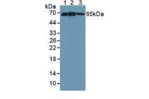 Western blot analysis of (1) Human 293T Cells, (2) Human HepG2 Cells and (3) Human Placenta Tissue. (KEAP1 抗体  (AA 327-624))