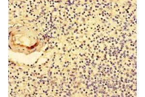 Immunohistochemistry of paraffin-embedded human spleen tissue using ABIN7161893 at dilution of 1:100 (NR1D1 抗体  (AA 246-558))