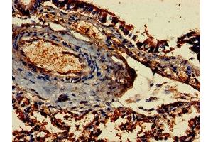 Immunohistochemistry of paraffin-embedded human lung tissue using ABIN7155188 at dilution of 1:100 (FCER1G 抗体  (AA 19-86))