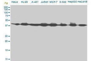 AHCY monoclonal antibody (M09), clone M2. (AHCY 抗体  (AA 1-432))