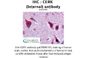 Image no. 1 for anti-Ceramide Kinase (CERK) (Internal Region) antibody (ABIN1733019) (CERK 抗体  (Internal Region))