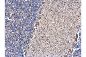 Immunohistochemistry (IHC) image for anti-Endoplasmic Reticulum Protein 29 (ERP29) antibody (ABIN2855330)