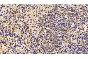 Immunohistochemistry (IHC) image for anti-Nuclear Factor kappa B (NFkB) (AA 42-367) antibody (ABIN7434137)