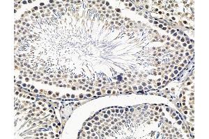 ABIN7096518 and ABIN7100582 at 1/100 staining rat testis tissue by IHC-P. (OSBPL11 抗体)