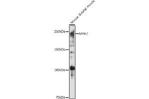 Western Blotting (WB) image for anti-Myosin Heavy Chain 2, Skeletal Muscle, Adult (MYH2) (AA 550-650) antibody (ABIN7268748)