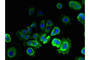 Immunofluorescent analysis of MCF-7 cells using ABIN7151978 at dilution of 1:100 and Alexa Fluor 488-congugated AffiniPure Goat Anti-Rabbit IgG(H+L) (TMEM93 抗体  (AA 2-47))