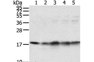 Western Blot analysis of Mouse brain and heart tissue, Jurkat, K562 and hela cell using TAF11 Polyclonal Antibody at dilution of 1:800 (TAF11 抗体)